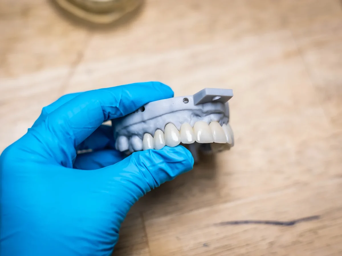 Dental bridge on a model held in a gloved hand