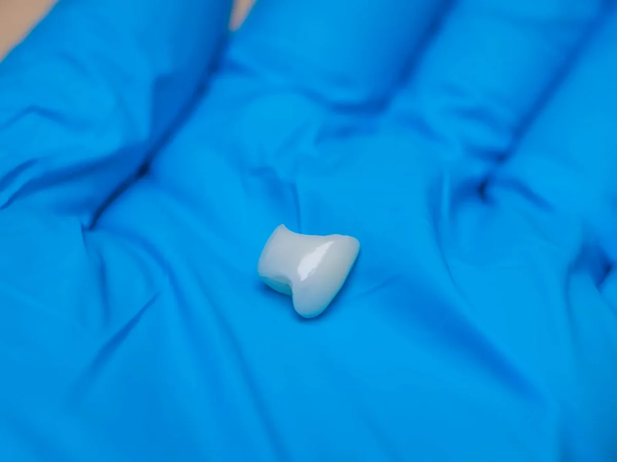 Emax crown on a blue glove