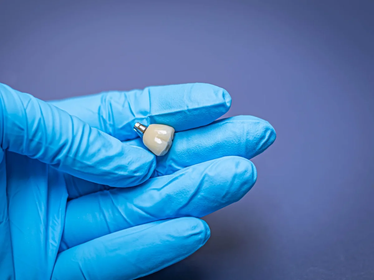 Implant crown on abutment held in a gloved hand