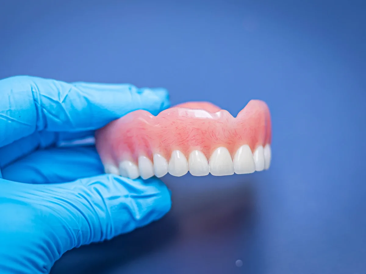 Upper denture held in a gloved hand