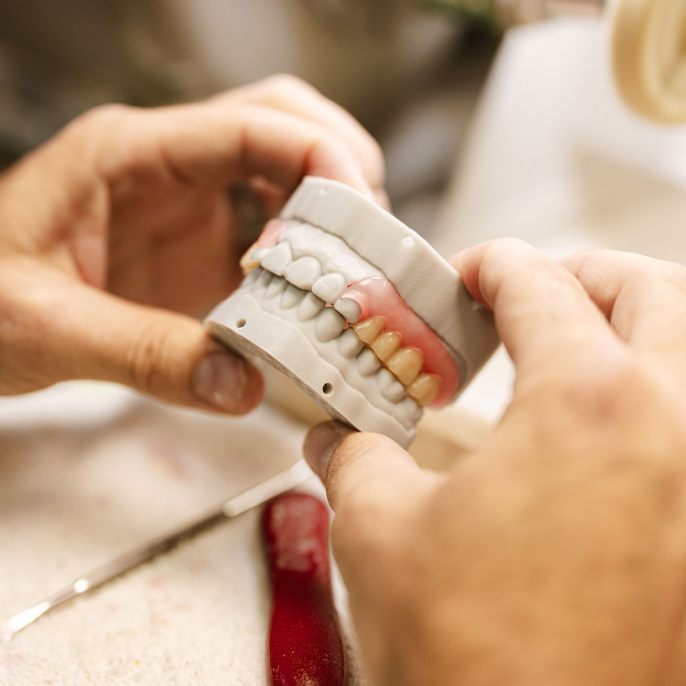 An acrylic partial denture seated on the articulated case at the IDA bench