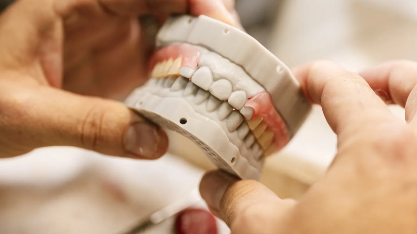 IDA technician checking occlusion on articulated complete dentures, a required step when restoring mini implants