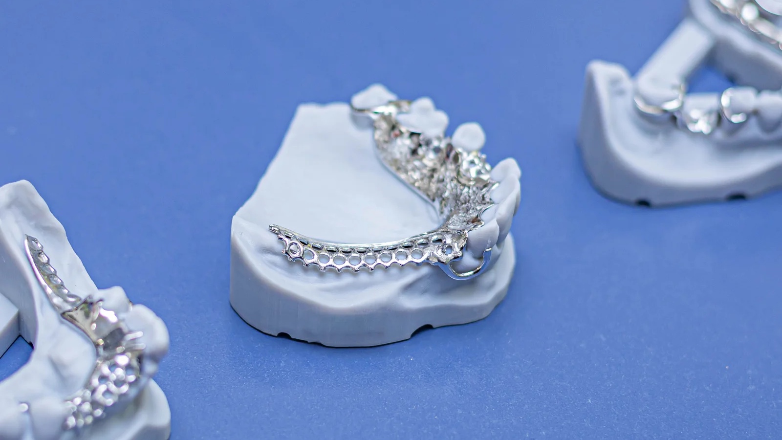 Chrome cobalt cast partial frameworks on master casts, the definitive prosthesis an interim partial denture is meant to lead to