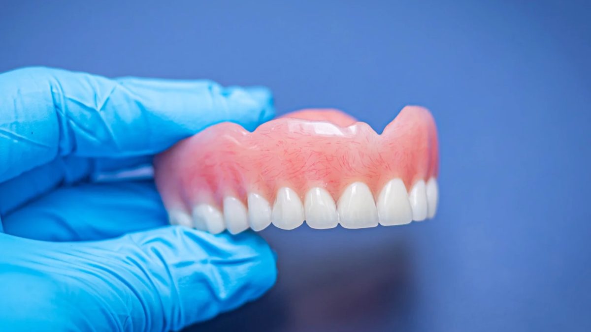 Finished upper complete denture held in a gloved hand